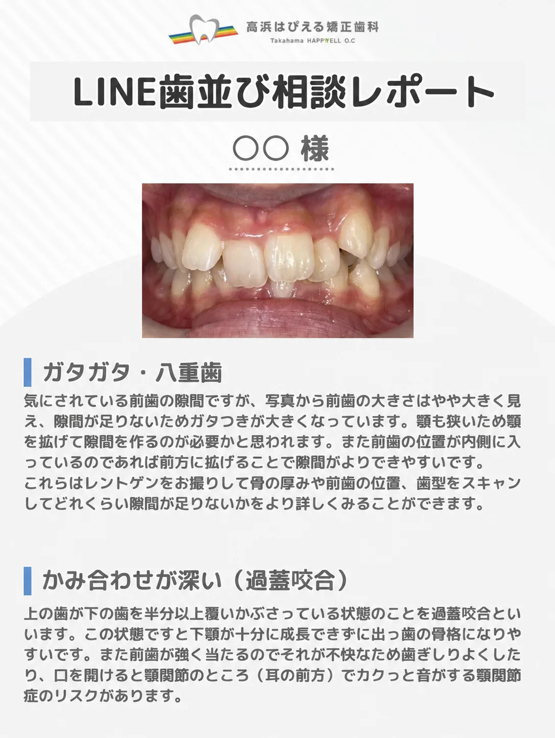LINE歯並び相談レポートのサンプル